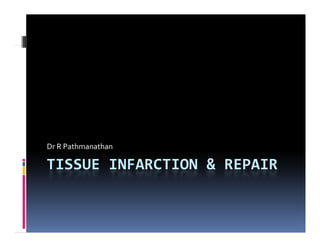 Tissue Infarction And Repair - Year 2