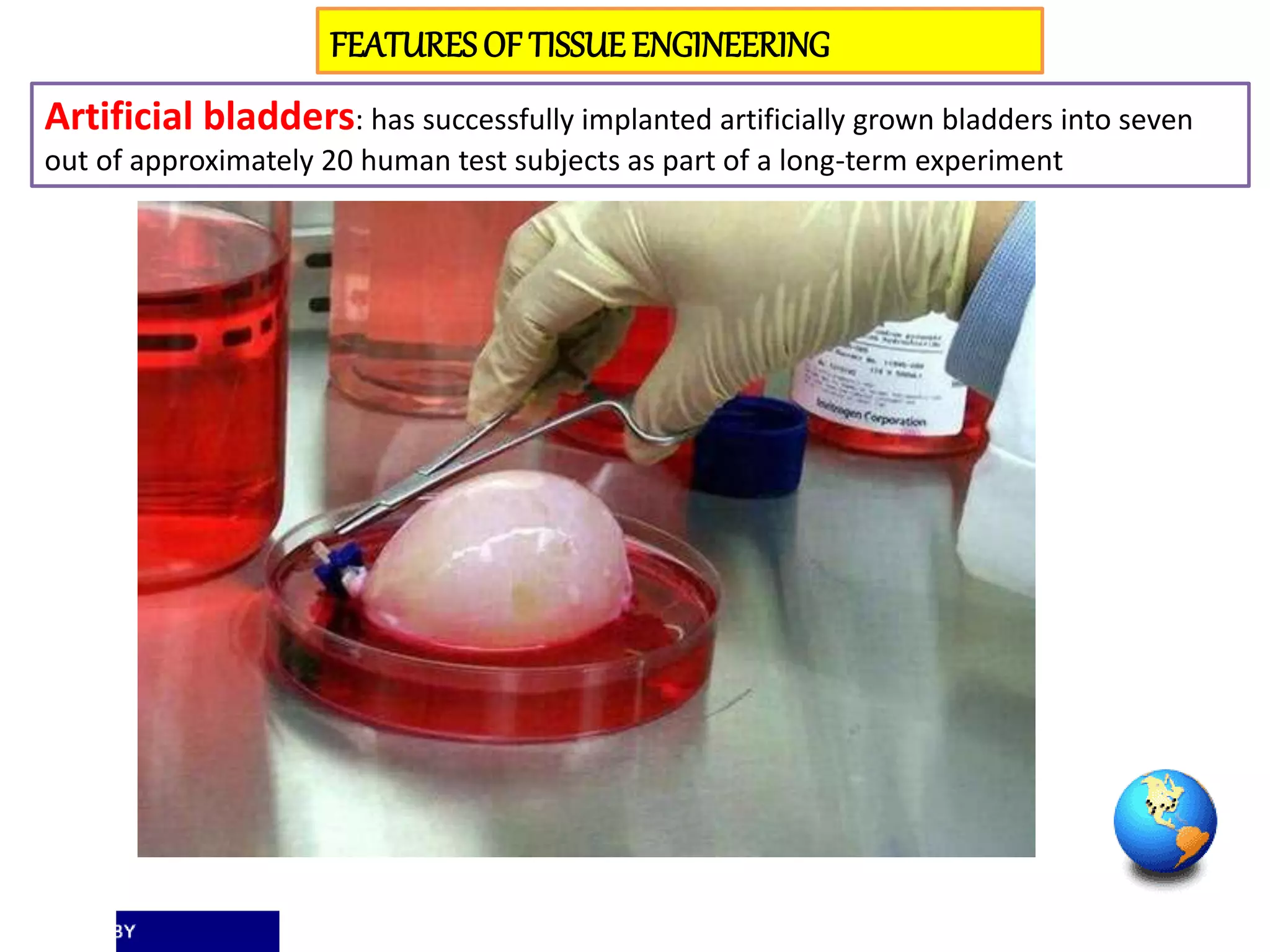 FEATURESOF TISSUEENGINEERING
Artificial bladders: has successfully implanted artificially grown bladders into seven
out of approximately 20 human test subjects as part of a long-term experiment
 