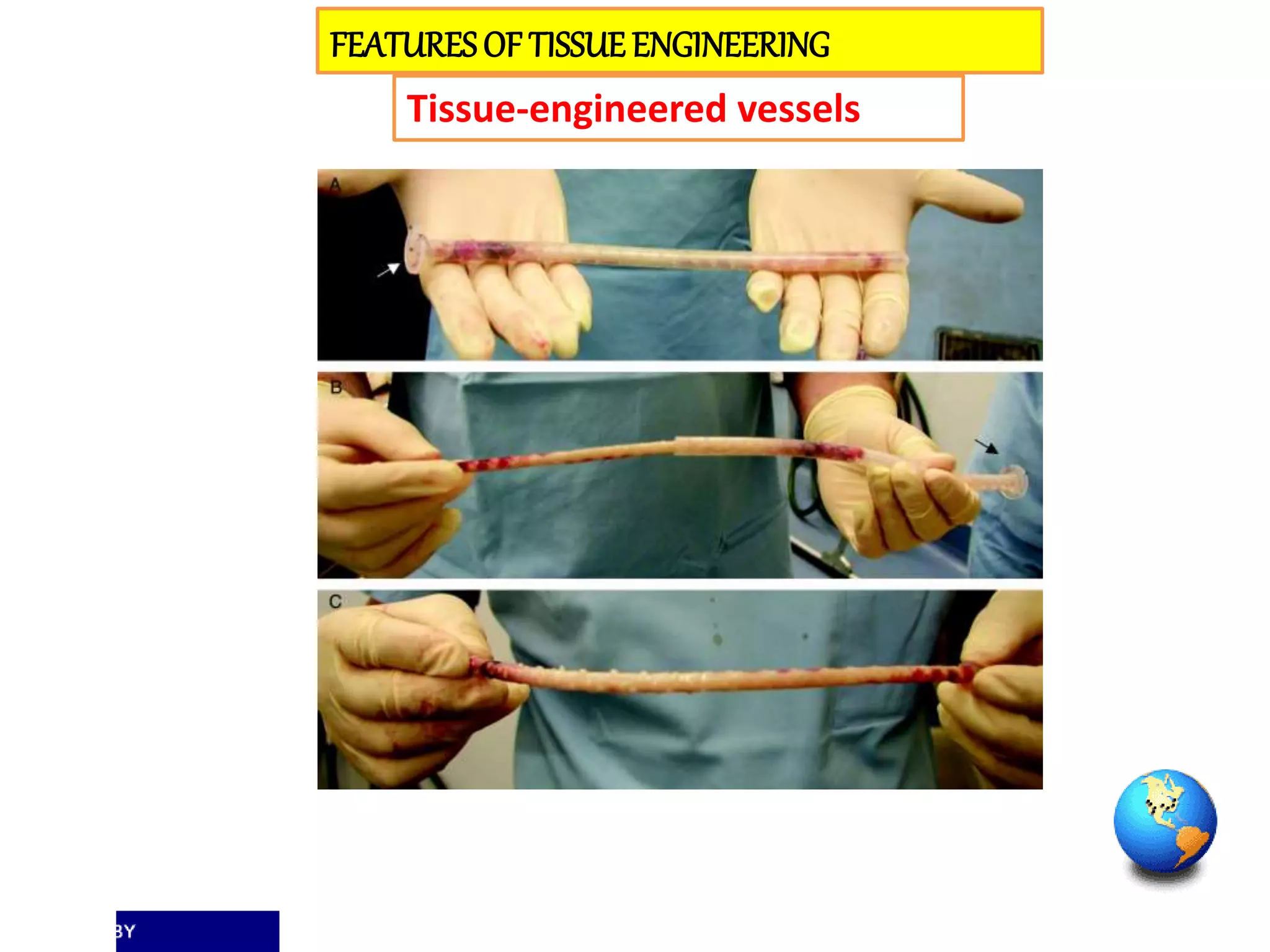 FEATURESOF TISSUEENGINEERING
Tissue-engineered vessels
 