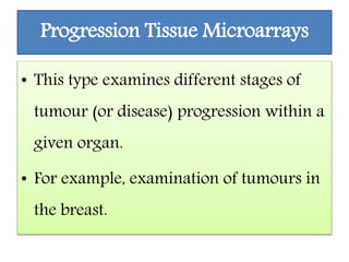Progression Tissue Microarrays
• This type examines different stages of
tumour (or disease) progression within a
given organ.
• For example, examination of tumours in
the breast.
 