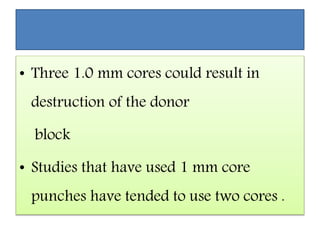• Three 1.0 mm cores could result in
destruction of the donor
block
• Studies that have used 1 mm core
punches have tended to use two cores .
 