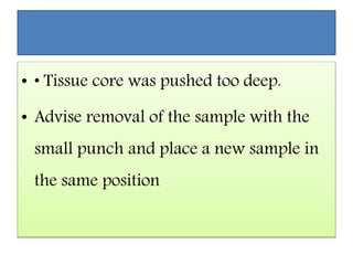• • Tissue core was pushed too deep.
• Advise removal of the sample with the
small punch and place a new sample in
the same position
 