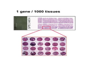 Comprehensive Overview of Tissue Microarray Technology in Pathology | PPTX