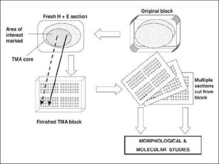 TISSUE MICROARRAY PRESENTATION.pptx