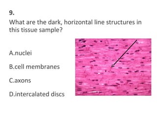 9.
What are the dark, horizontal line structures in
this tissue sample?
A.nuclei
B.cell membranes
C.axons
D.intercalated discs
 