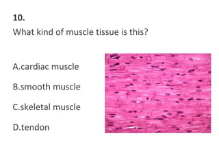 10.
What kind of muscle tissue is this?
A.cardiac muscle
B.smooth muscle
C.skeletal muscle
D.tendon
 