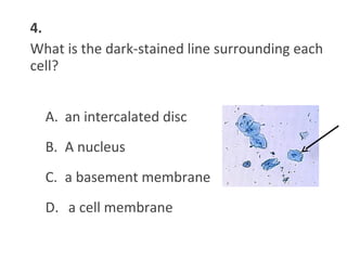 4.
What is the dark-stained line surrounding each
cell?
A. an intercalated disc
B. A nucleus
C. a basement membrane
D. a cell membrane
 