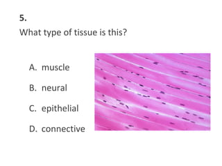 5.
What type of tissue is this?
A. muscle
B. neural
C. epithelial
D. connective
 