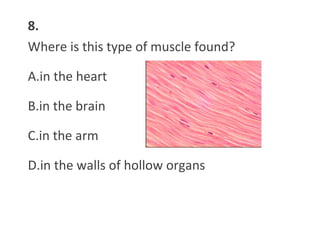 8.
Where is this type of muscle found?
A.in the heart
B.in the brain
C.in the arm
D.in the walls of hollow organs
 