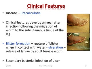 Clinical Features
• Disease – Dracunculosis
• Clinical features develop an year after
infection following the migration of
worm to the subcutaneous tissue of the
leg
• Blister formation – rupture of blister
when in contact with water - ulceration –
release of larvae by adult female worm
• Secondary bacterial infection of ulcer
7/9/2021 Dept of Microbiology 54
 