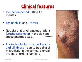 Clinical features
• Incubation period - 10 to 12
months.
• Eosinophilia and urticaria.
• Nodular and erythematous lesions
(Onchocercomata) in the skin and
subcutaneous tissue.
• Photophobia, lacrimation, keratitis
and blindness – due to trapping of
microfilaria in the cornea, choroid,
iris and anterior chambers.
9/21/2021 Dept of Microbiology 45
 