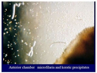 9/21/2021 Dept of Microbiology 46
 