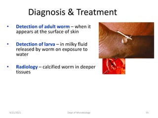 Diagnosis & Treatment
• Detection of adult worm – when it
appears at the surface of skin
• Detection of larva – in milky fluid
released by worm on exposure to
water
• Radiology – calcified worm in deeper
tissues
9/21/2021 Dept of Microbiology 55
 