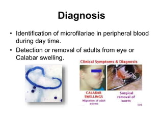 Diagnosis
• Identification of microfilariae in peripheral blood
during day time.
• Detection or removal of adults from eye or
Calabar swelling.
 