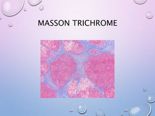 MASSON TRICHROME
 