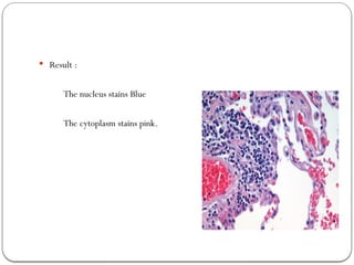  Result :
The nucleus stains Blue
The cytoplasm stains pink.
 