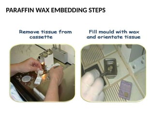 Tissue processing in histopathology -4.pptx