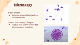 Tissue Protozoa Small group discussion.pdf