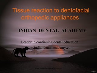 Tissue reaction to dentofacial
orthopedic appliances
INDIAN DENTAL ACADEMY
Leader in continuing dental education
www.indiandentalacademy.com

www.indiandentalacademy.com

 
