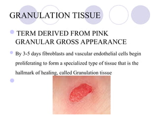 Gradunation Tissue TISSUE RENEWAL AND REPAIR - body’s ability to replace injured.ppt