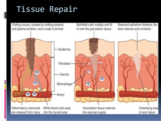 Stages Of Tissue Repair _ Full article: Tissue repair – YAXN