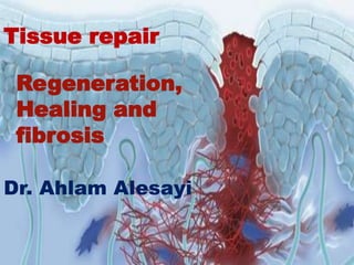 Tissue repair
Regeneration,
Healing and
fibrosis
Dr. Ahlam Alesayi
 