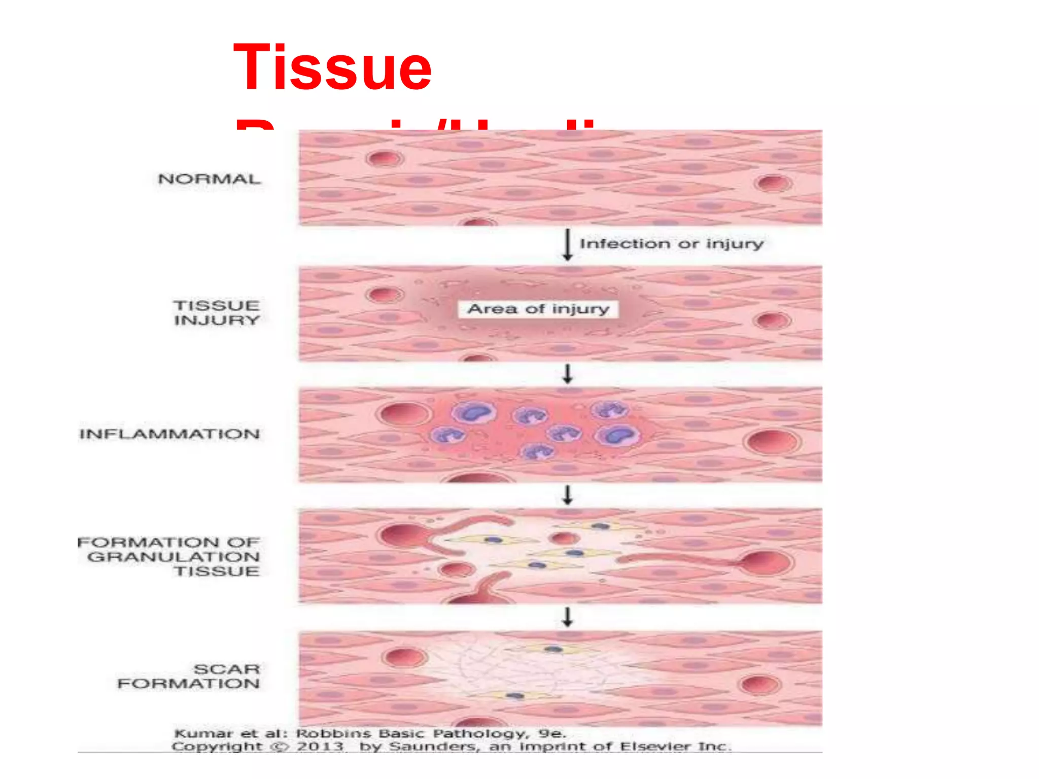 Tissue
Repair/Healing
 