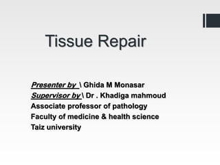Tissue Repair
Ghida M Monasar

Presenter by
Supervisor by  Dr . Khadiga mahmoud
Associate professor of pathology
Faculty of medicine & health science
Taiz university
 