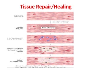 Comprehensive Overview of Tissue Repair and Wound Healing Processes in ...