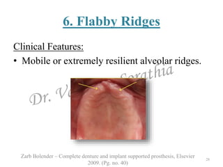 Flaring Ridge Defect Tissue response to cd and preventing and treating the abused tissues | PPTX