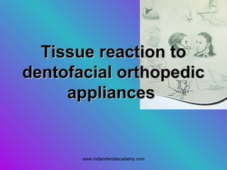 Tissue reaction toTissue reaction to
dentofacial orthopedicdentofacial orthopedic
appliancesappliances
www.indiandentalacademy.com
 