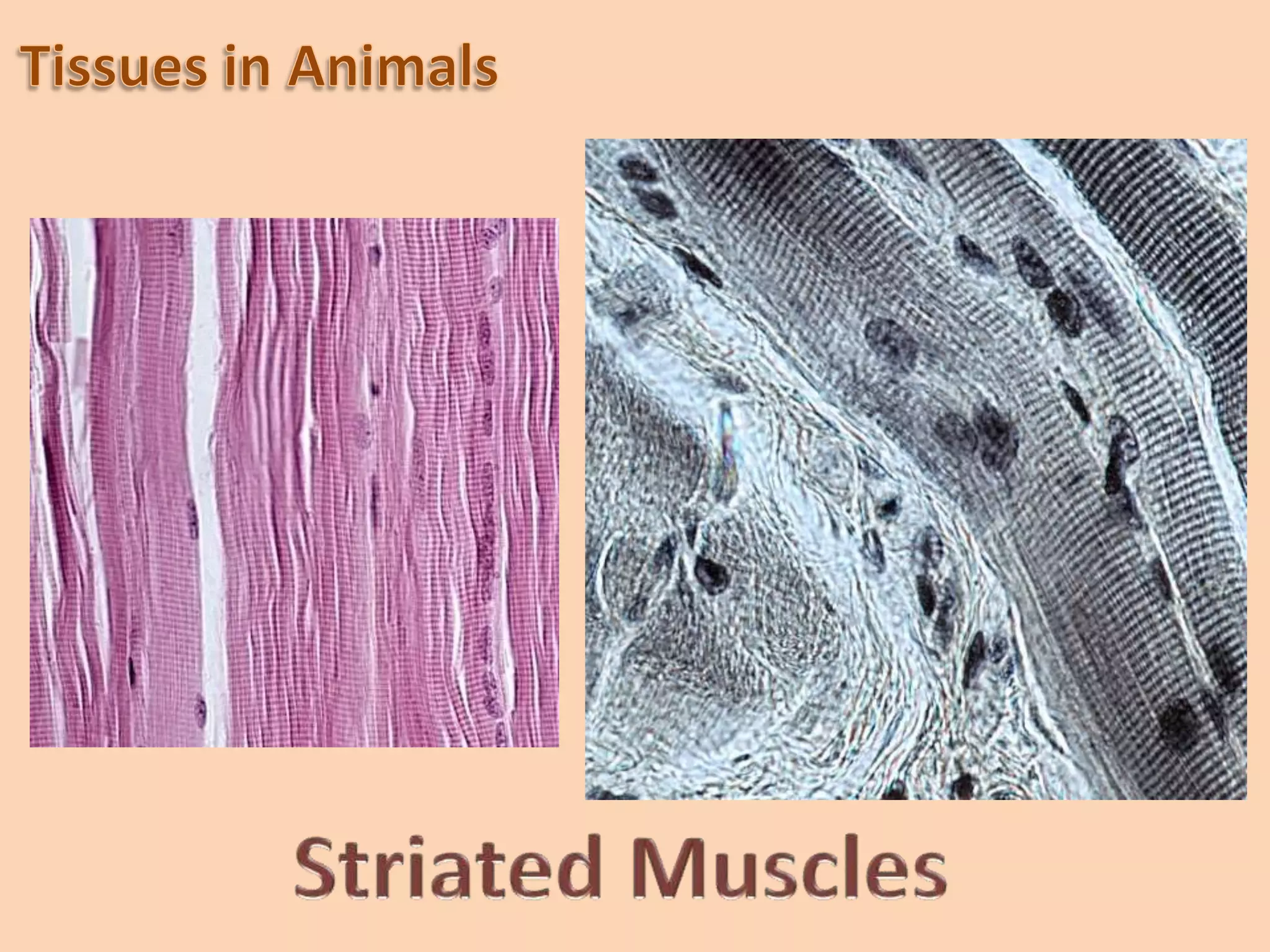 Connective TissueIt is an animal tissue that is characterized by the abundance of extracellular components (such as fibers and intercellular substances). The tissue derives its name from its function in connecting, supporting, surrounding  or binding cells and tissues. Connective tissue is composed of: cells