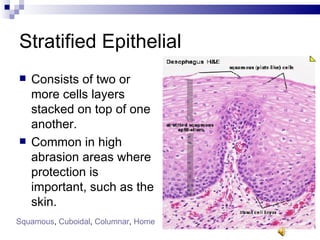 Stratified Epithelial Consists of two or more cells layers stacked on top of one another. Common in high abrasion areas where protection is important, such as the skin. Squamous ,  Cuboidal ,  Columnar ,  Home 