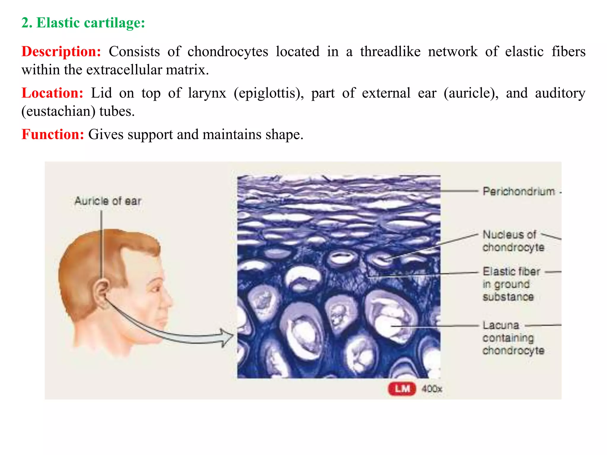 2. Elastic cartilage:
Description: Consists of chondrocytes located in a threadlike network of elastic fibers
within the extracellular matrix.
Location: Lid on top of larynx (epiglottis), part of external ear (auricle), and auditory
(eustachian) tubes.
Function: Gives support and maintains shape.
 