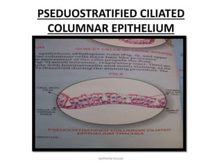 PSEDUOSTRATIFIED CILIATED
COLUMNAR EPITHELIUM
epithelial tissues
 