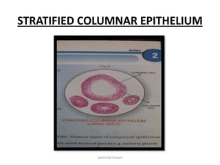 STRATIFIED COLUMNAR EPITHELIUM
epithelial tissues
 
