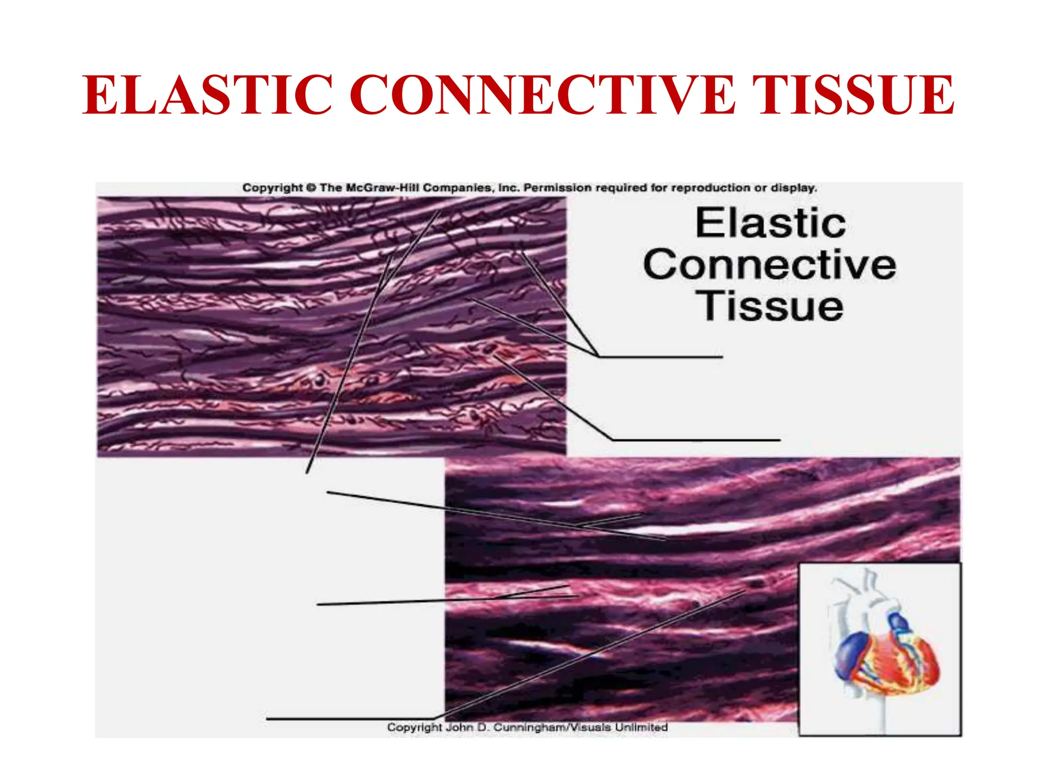 ELASTIC CONNECTIVE TISSUE
 