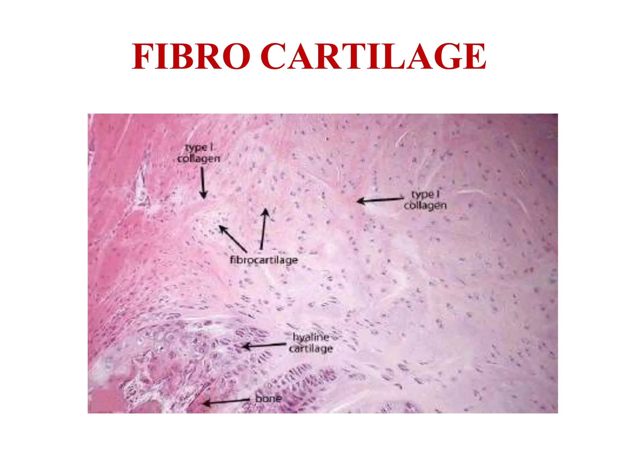 FIBRO CARTILAGE
 