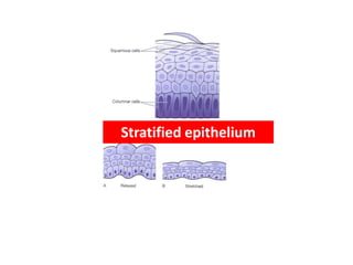 Stratified epithelium
 