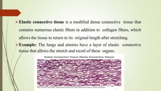 Elastic Tissue Examples Here's a complete presentation on the topic of