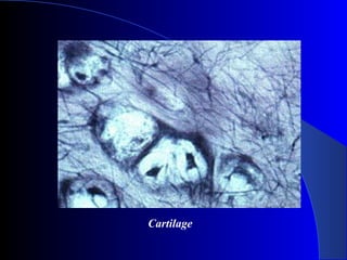 Cartilage
 