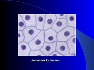 Squamous Epithelium
 