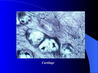 Cartilage 