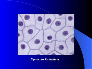 Squamous Epithelium 