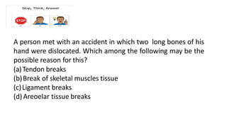A person met with an accident in which two long bones of his
hand were dislocated. Which among the following may be the
possible reason for this?
(a)Tendon breaks
(b)Break of skeletal muscles tissue
(c)Ligament breaks
(d)Areoelar tissue breaks
 