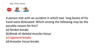 A person met with an accident in which two long bones of his
hand were dislocated. Which among the following may be the
possible reason for this?
(a)Tendon breaks
(b)Break of skeletal muscles tissue
(c)Ligament breaks
(d)Areoelar tissue breaks
 