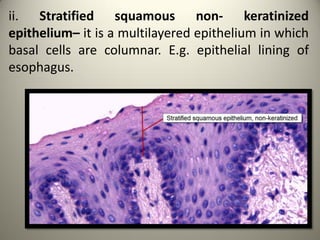 ii. Stratified squamous non- keratinized
epithelium– it is a multilayered epithelium in which
basal cells are columnar. E.g. epithelial lining of
esophagus.
 