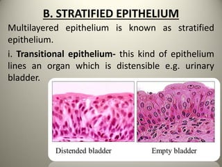 B. STRATIFIED EPITHELIUM
Multilayered epithelium is known as stratified
epithelium.
i. Transitional epithelium- this kind of epithelium
lines an organ which is distensible e.g. urinary
bladder.
 
