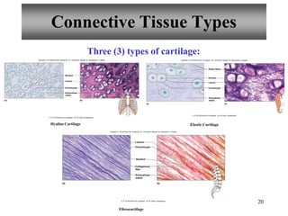 20
Connective Tissue Types
Three (3) types of cartilage:
Copyright © The McGraw-Hill Companies, Inc. Permission required for reproduction or display. Copyright © The McGraw-Hill Companies, Inc. Permission required for reproduction or display.
Hyaline Cartilage Elastic Cartilage
Fibrocartilage
Chondrocyte
Nucleus
Extracellular
matrix
(a) (b)
Lacuna
b: © The McGraw-Hill Companies, Inc./Al Telser, photographer
Chondrocyte
Elastic fibers
Nucleus
Extracellular
matrix
(a) (b)
Lacuna
b: © The McGraw-Hill Companies, Inc./Al Telser, photographer
Nucleus
Collagenous
fiber
Extracellular
matrix
(a) (b)
Lacuna
Chondrocyte
Copyright © The McGraw-Hill Companies, Inc. Permission required for reproduction or display.
b: © The McGraw-Hill Companies, Inc./Al Telser, photographer
 
