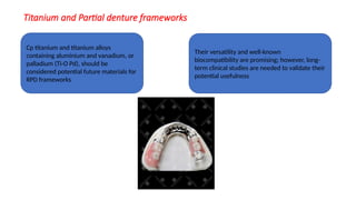 Titanium Base Rpd TITANIUM AND ITS ALLOYS in prosthodontics | PPTX